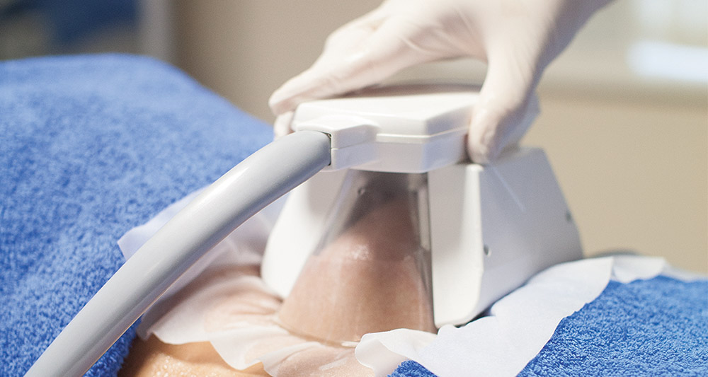How Fat Freezing and HIFU Work Together? 2 Multiple Areas in One Session HIFU and Fat Freezing Newbury