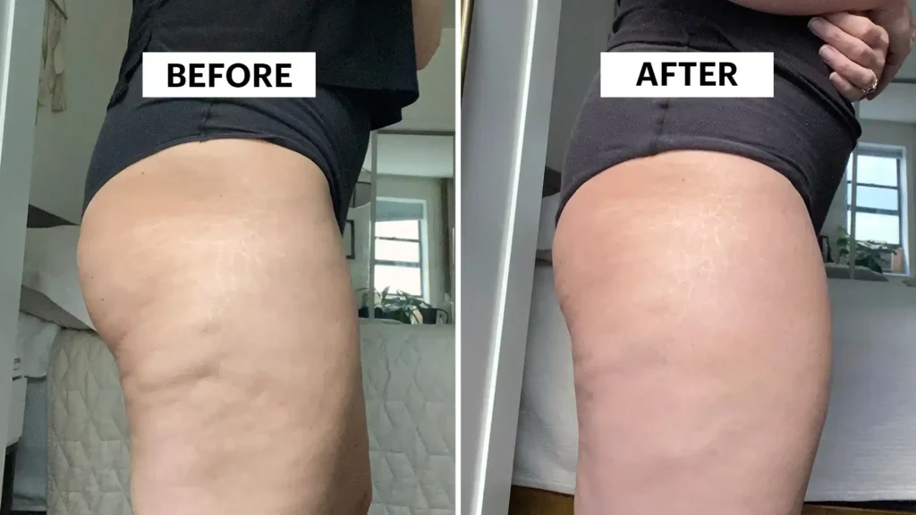 Do Toning Exercise Newbury 	 Really Tackle Cellulite?
